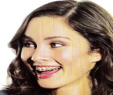 Gbdental - Fém önligírozó