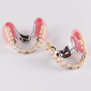 Kombimált fogpótlás